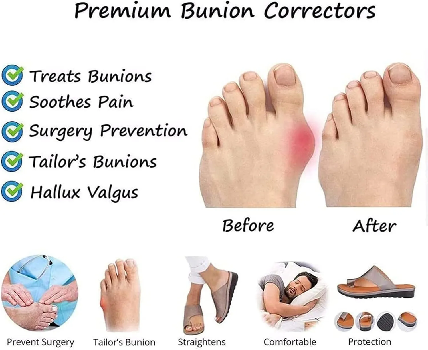 Bunion Orthopedic Sandals for Womens,Casual Lightweight Hallux Valgus Flat Slippers,Summer Roman Travel Ladies Beach Flip Flops,for Plantar Fasciitis/Foot Correction